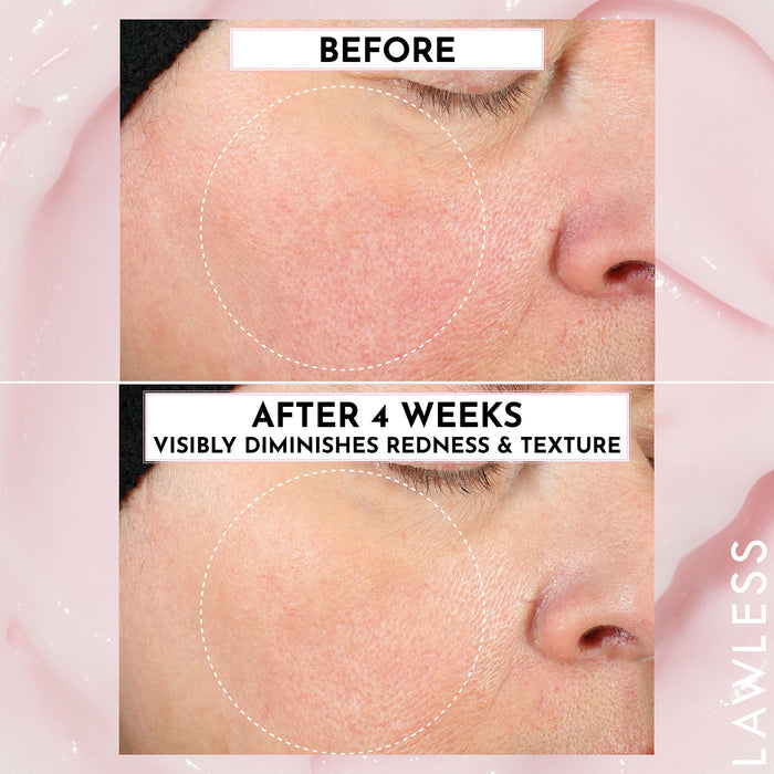 Forget the Filler Oil-Free Skin-Plumping Line Smoothing Perfecting Cream
