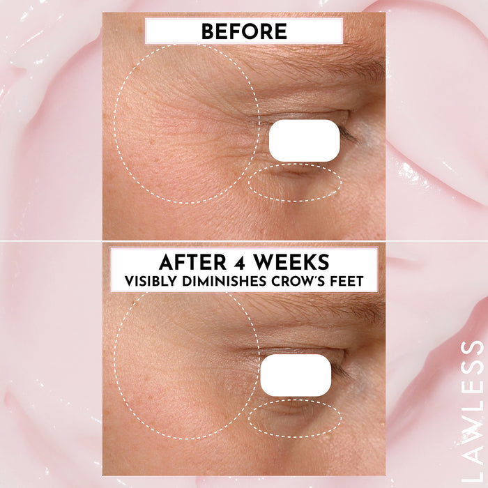 Forget the Filler Oil-Free Skin-Plumping Line Smoothing Perfecting Cream