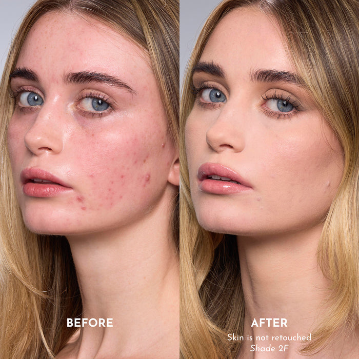 Forget The Filler Skin-Plumping Line-Smoothing Foundation