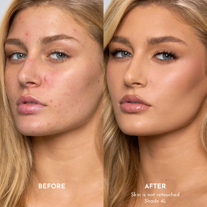 Forget The Filler Skin-Plumping Line-Smoothing Foundation